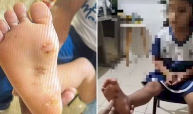 Mãe e padrasto são presos suspeitos de torturar e queimar com isqueiro menina de 4 anos